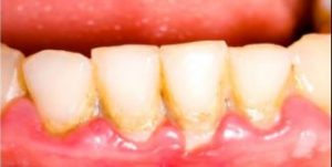 Read more about the article ORAL AND DENTAL DISEASES